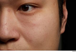 HD Face Skin Shinobu Guykudo cheek eye face nose skin…